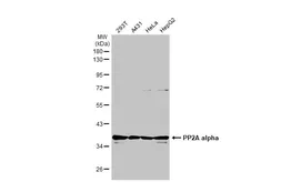 Anti-PP2A alpha antibody used in Western Blot (WB). GTX130434