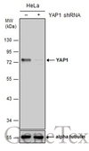 Anti-YAP1 antibody used in Western Blot (WB). GTX130444