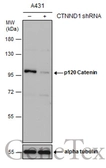 Anti-p120 Catenin antibody used in Western Blot (WB). GTX130448