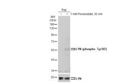 Anti-LYN (phospho Tyr397) antibody used in Western Blot (WB). GTX130454