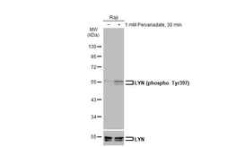 Anti-LYN (phospho Tyr397) antibody used in Western Blot (WB). GTX130454