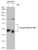 Anti-Tau (phospho Ser198) antibody used in Western Blot (WB). GTX130456