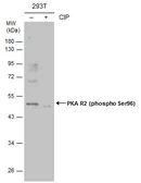 Anti-PKA R2 (phospho Ser96) antibody used in Western Blot (WB). GTX130457