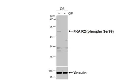 Anti-PKA R2 (phospho Ser99) antibody used in Western Blot (WB). GTX130457