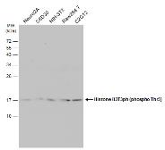 Anti-Histone H3T3ph (phospho Thr3) antibody used in Western Blot (WB). GTX130458