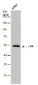 Anti-LYN antibody used in Western Blot (WB). GTX130460