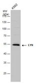 Anti-LYN antibody used in Western Blot (WB). GTX130460