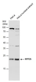 Anti-RPP25 antibody used in Western Blot (WB). GTX130473