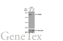 Anti-PHD2 antibody used in Western Blot (WB). GTX130482