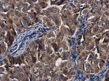 Anti-TDRD1 antibody used in IHC (Paraffin sections) (IHC-P). GTX130485