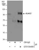 Anti-ELAC2 antibody used in Immunoprecipitation (IP). GTX130499