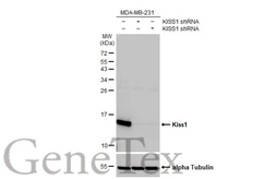 Anti-Kiss1 antibody used in Western Blot (WB). GTX130503