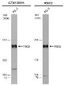 Anti-TSC2 antibody used in Western Blot (WB). GTX130511