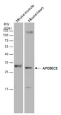 Anti-APOBEC2 antibody used in Western Blot (WB). GTX130521