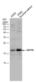 Anti-SAP18 antibody used in Western Blot (WB). GTX130522