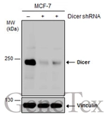 Anti-Dicer antibody used in Western Blot (WB). GTX130536