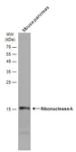 Anti-Ribonuclease A antibody used in Western Blot (WB). GTX130540
