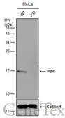 Anti-PBR antibody used in Western Blot (WB). GTX130550