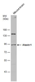 Anti-Ataxin 1 antibody used in Western Blot (WB). GTX130595