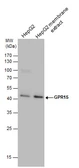 Anti-GPR15 antibody used in Western Blot (WB). GTX130628