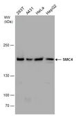 Anti-SMC4 antibody used in Western Blot (WB). GTX130649
