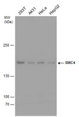 Anti-SMC4 antibody used in Western Blot (WB). GTX130650