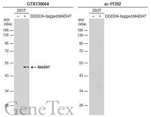 Anti-MADH7 antibody used in Western Blot (WB). GTX130664