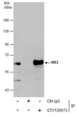 Anti-ME2 antibody used in Immunoprecipitation (IP). GTX130673