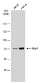 Anti-Wip1 antibody used in Western Blot (WB). GTX130700