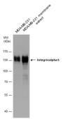 Anti-Integrin alpha 5 antibody used in Western Blot (WB). GTX130705
