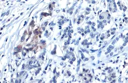 Anti-Glypican-3 antibody used in IHC (Paraffin sections) (IHC-P). GTX130732