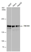 Anti-TBC1D1 antibody used in Western Blot (WB). GTX130740