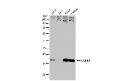 Anti-LASS2 antibody used in Western Blot (WB). GTX130744