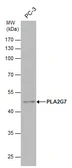 Anti-PLA2G7 antibody used in Western Blot (WB). GTX130757