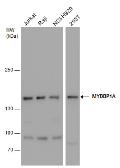 Anti-MYBBP1A antibody used in Western Blot (WB). GTX130760