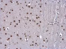 Anti-BTF antibody used in IHC (Paraffin sections) (IHC-P). GTX130772