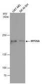Anti-MYO5A antibody used in Western Blot (WB). GTX130793