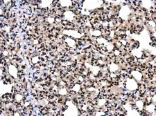Anti-SNF2H antibody used in IHC (Paraffin sections) (IHC-P). GTX130794