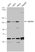 Anti-DIAPH3 antibody used in Western Blot (WB). GTX130803