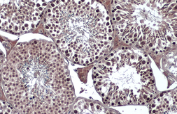 Anti-VRK2 antibody used in IHC (Paraffin sections) (IHC-P). GTX130826