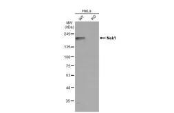 Anti-Nek1 antibody used in Western Blot (WB). GTX130828