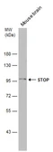 Anti-STOP antibody used in Western Blot (WB). GTX130830