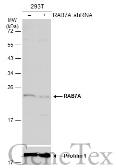 Anti-RAB7A antibody used in Western Blot (WB). GTX130847