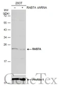 Anti-RAB7A antibody used in Western Blot (WB). GTX130847