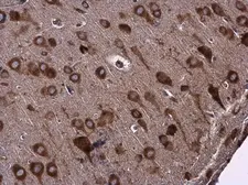 Anti-EPRS antibody used in IHC (Paraffin sections) (IHC-P). GTX130848