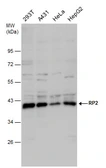 Anti-RP2 antibody used in Western Blot (WB). GTX130862