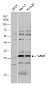 Anti-GAMT antibody used in Western Blot (WB). GTX130872