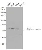Anti-Calcitonin Receptor antibody used in Western Blot (WB). GTX130873