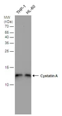 Anti-Cystatin A antibody used in Western Blot (WB). GTX130885