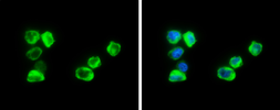 Anti-Cystatin A antibody used in Immunocytochemistry/ Immunofluorescence (ICC/IF). GTX130885